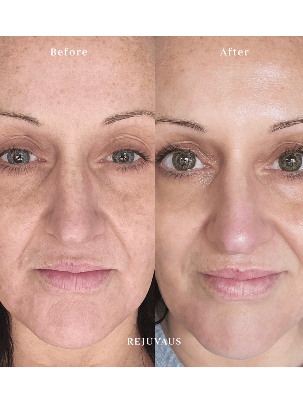 Retinol Serum Review