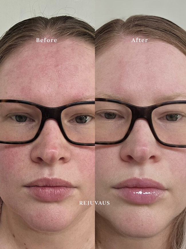 Bright & Correct Niacinamide Serum 10ml