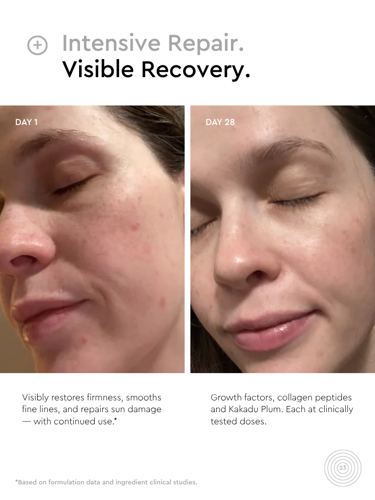 aging skin skincare results