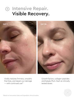 aging skin skincare results