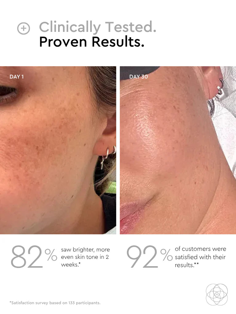 pigmentation serum results