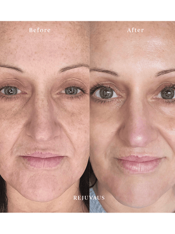 Retinol Serum Review